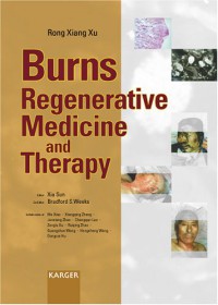 Image of Burns Regenerative Medicine and Therapy