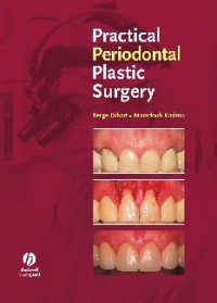 Image of Practical Periodontal Plastic Surgery
