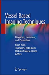 Image of Vessel Based Imaging Techniques